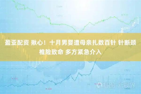 盈亚配资 揪心！十月男婴遭母亲扎数百针 针断颈椎险致命 多方紧急介入